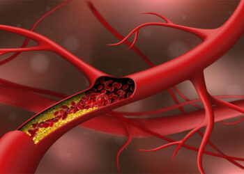 ചീത്ത കൊളസ്ട്രോൾ കുറയ്ക്കാം. ഡയറ്റില്‍ ഈ ഭക്ഷണങ്ങള്‍ ഉള്‍പ്പെടുത്തിയാൽ